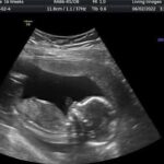 Gender Reveal Package ultrasound image in Shalimar Fort Walton Beach