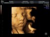30 weeks 4D ultrasound