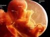 12 week fetus 3D ultrasound Fort Walton Beach
