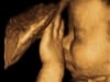 baby 4D ultrasound gallery