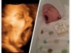 baby yawn 3D ultrasound Fort Walton Beach